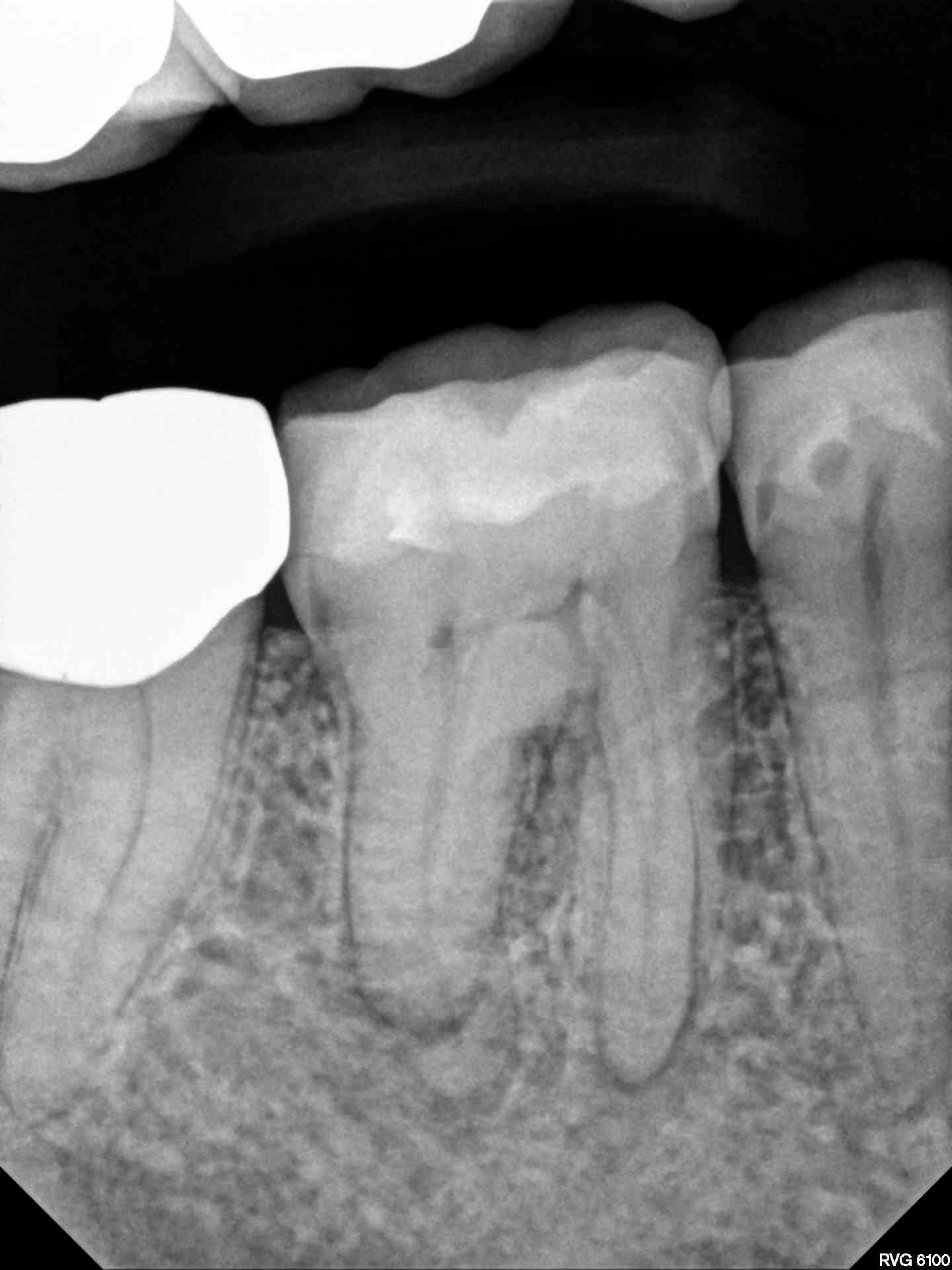 Image of tooth.