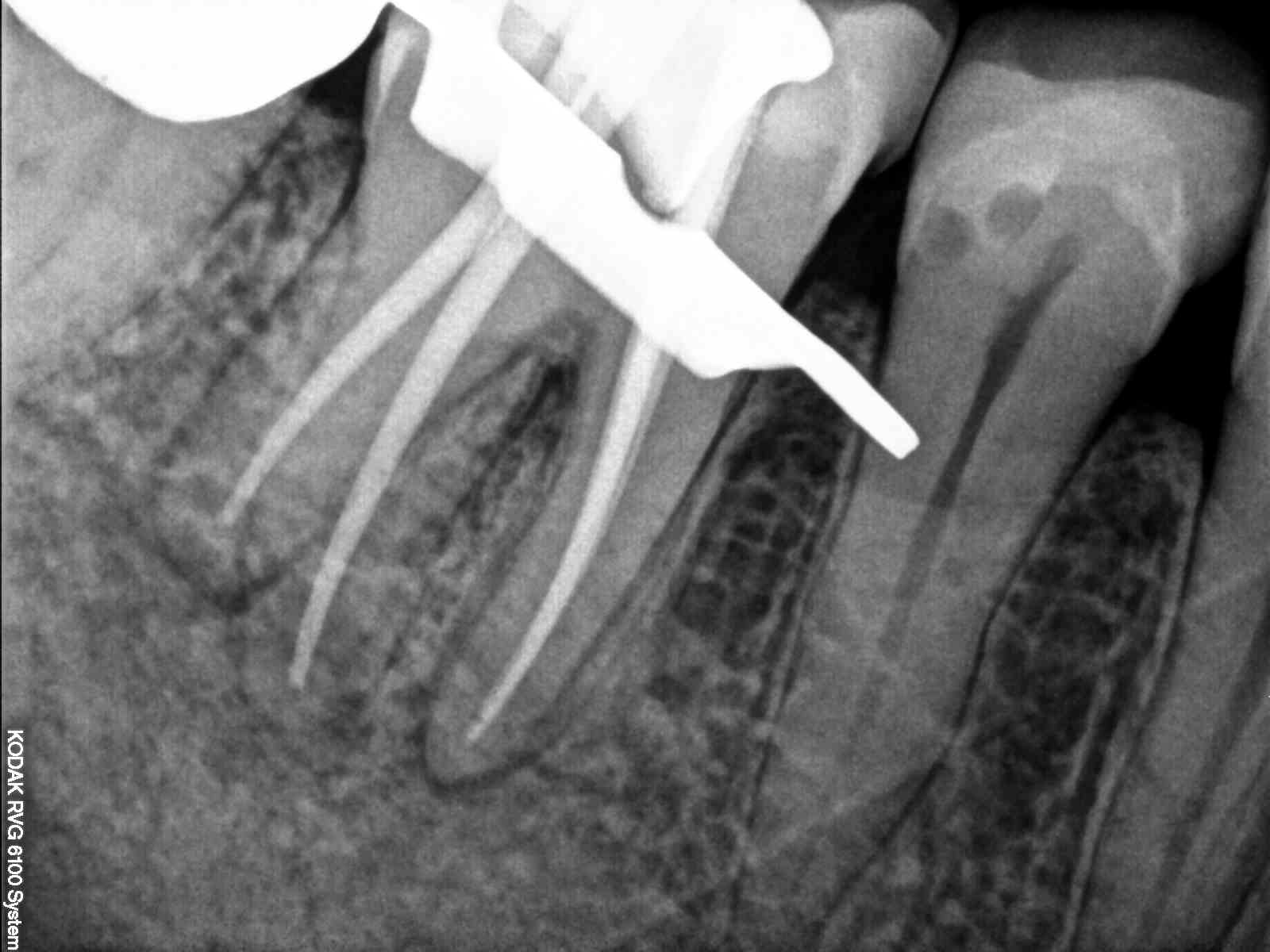 Dental image.
