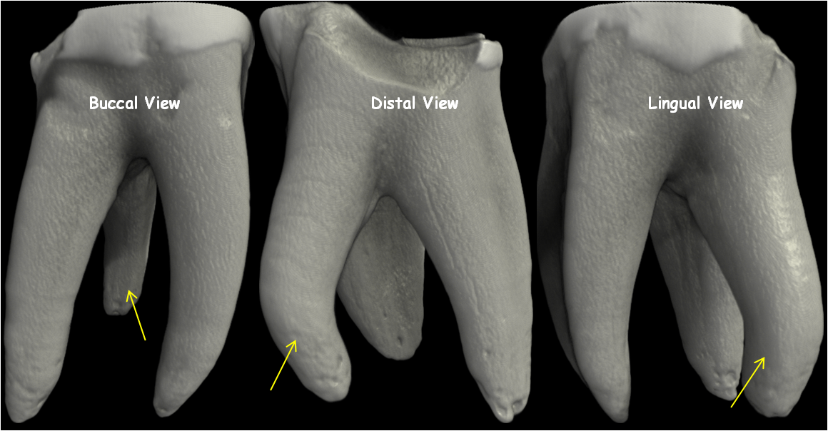 Image of teeth.